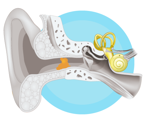 Diagram of the inner ear
